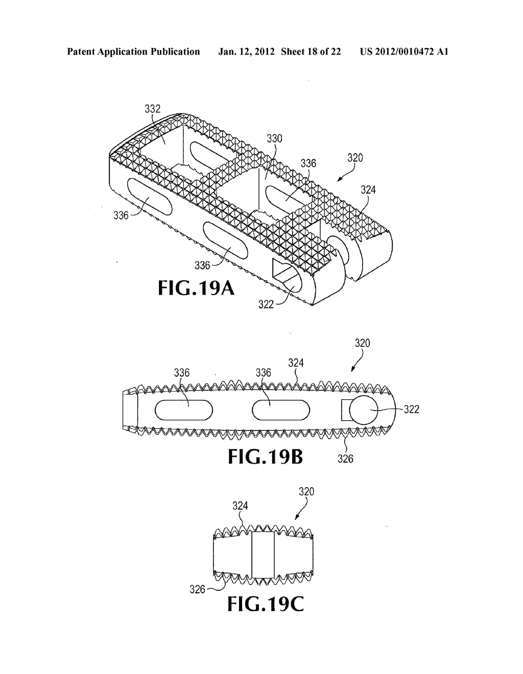 RETRACTOR FOR USE DURING RETROPERITONEAL LATERAL INSERTION OF SPINAL     IMPLANTS - diagram, schematic, and image 19