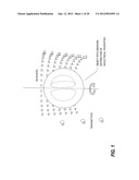 SYSTEMS AND METHODS OF 4D  ELECTROMAGNETIC TOMOGRAPHIC (EMT) DIFFERENTIAL     (DYNAMIC) FUSED IMAGING diagram and image