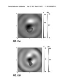 SYSTEMS AND METHODS OF 4D  ELECTROMAGNETIC TOMOGRAPHIC (EMT) DIFFERENTIAL     (DYNAMIC) FUSED IMAGING diagram and image