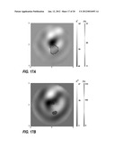 SYSTEMS AND METHODS OF 4D  ELECTROMAGNETIC TOMOGRAPHIC (EMT) DIFFERENTIAL     (DYNAMIC) FUSED IMAGING diagram and image