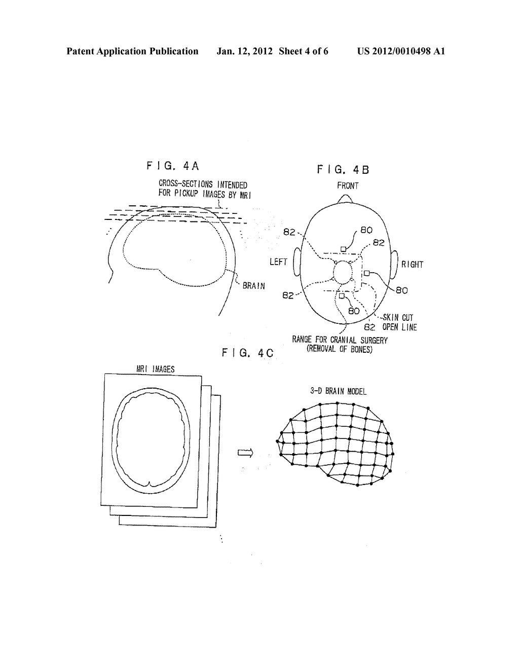 OPERATION SUPPORTING DEVICE, METHOD, AND PROGRAM - diagram, schematic, and image 05