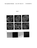 USE OF NANOPARTICLES FOR THE TREATMENT OF CANCER diagram and image