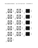 Chemically-selective, label free, microendoscopic system based on coherent     anti-stokes raman scattering and microelectromechanical fiber optic probe diagram and image