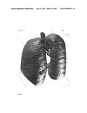 Chemically-selective, label free, microendoscopic system based on coherent     anti-stokes raman scattering and microelectromechanical fiber optic probe diagram and image