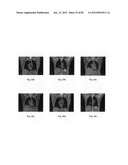 Chemically-selective, label free, microendoscopic system based on coherent     anti-stokes raman scattering and microelectromechanical fiber optic probe diagram and image