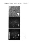 Chemically-selective, label free, microendoscopic system based on coherent     anti-stokes raman scattering and microelectromechanical fiber optic probe diagram and image