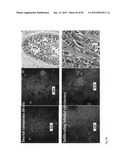 Chemically-selective, label free, microendoscopic system based on coherent     anti-stokes raman scattering and microelectromechanical fiber optic probe diagram and image