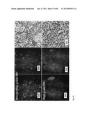 Chemically-selective, label free, microendoscopic system based on coherent     anti-stokes raman scattering and microelectromechanical fiber optic probe diagram and image