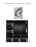 Chemically-selective, label free, microendoscopic system based on coherent     anti-stokes raman scattering and microelectromechanical fiber optic probe diagram and image