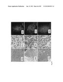 Chemically-selective, label free, microendoscopic system based on coherent     anti-stokes raman scattering and microelectromechanical fiber optic probe diagram and image