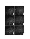 Chemically-selective, label free, microendoscopic system based on coherent     anti-stokes raman scattering and microelectromechanical fiber optic probe diagram and image