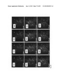 Chemically-selective, label free, microendoscopic system based on coherent     anti-stokes raman scattering and microelectromechanical fiber optic probe diagram and image