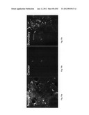 Chemically-selective, label free, microendoscopic system based on coherent     anti-stokes raman scattering and microelectromechanical fiber optic probe diagram and image