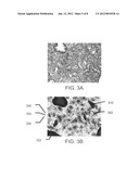 Systems and methods for predicting disease progression in patients treated     with radiotherapy diagram and image