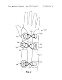 WRIST BRACE diagram and image