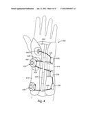 WRIST BRACE diagram and image