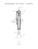 CERVICAL TRACTION MECHANISM diagram and image