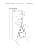 CERVICAL TRACTION MECHANISM diagram and image