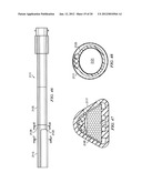 SYSTEM FOR PERCUTANEOUSLY ADMINISTERING REDUCED PRESSURE TREATMENT USING     BALLOON DISSECTION diagram and image