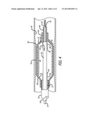 BALLOON CATHETER WITH IMPROVED TAPER SUPPORT diagram and image