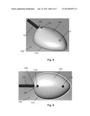 Intravenous Catheter Protective Cover diagram and image