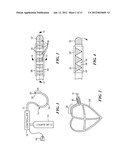 CRYOSURGICAL CATHETER diagram and image