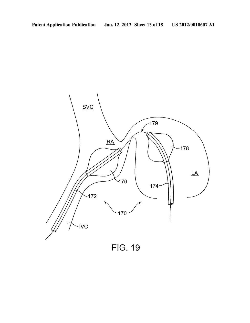 ENERGY BASED DEVICES AND METHODS FOR TREATMENT OF PATENT FORAMEN OVALE - diagram, schematic, and image 14