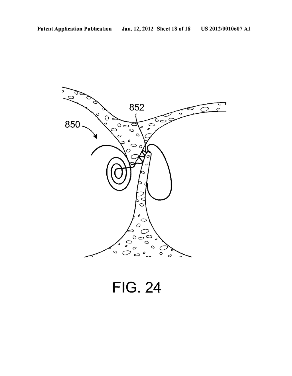 ENERGY BASED DEVICES AND METHODS FOR TREATMENT OF PATENT FORAMEN OVALE - diagram, schematic, and image 19