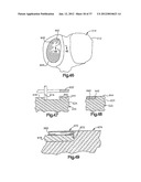 CANNULATED SYSTEMS diagram and image