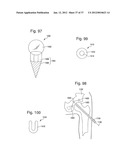 CANNULATED SYSTEMS diagram and image