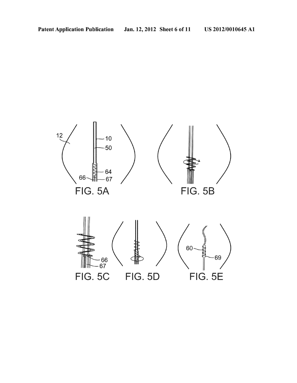 METHODS AND DEVICES FOR URETHRAL TREATMENT - diagram, schematic, and image 07