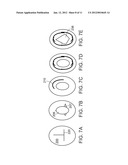 METHODS AND DEVICES FOR URETHRAL TREATMENT diagram and image