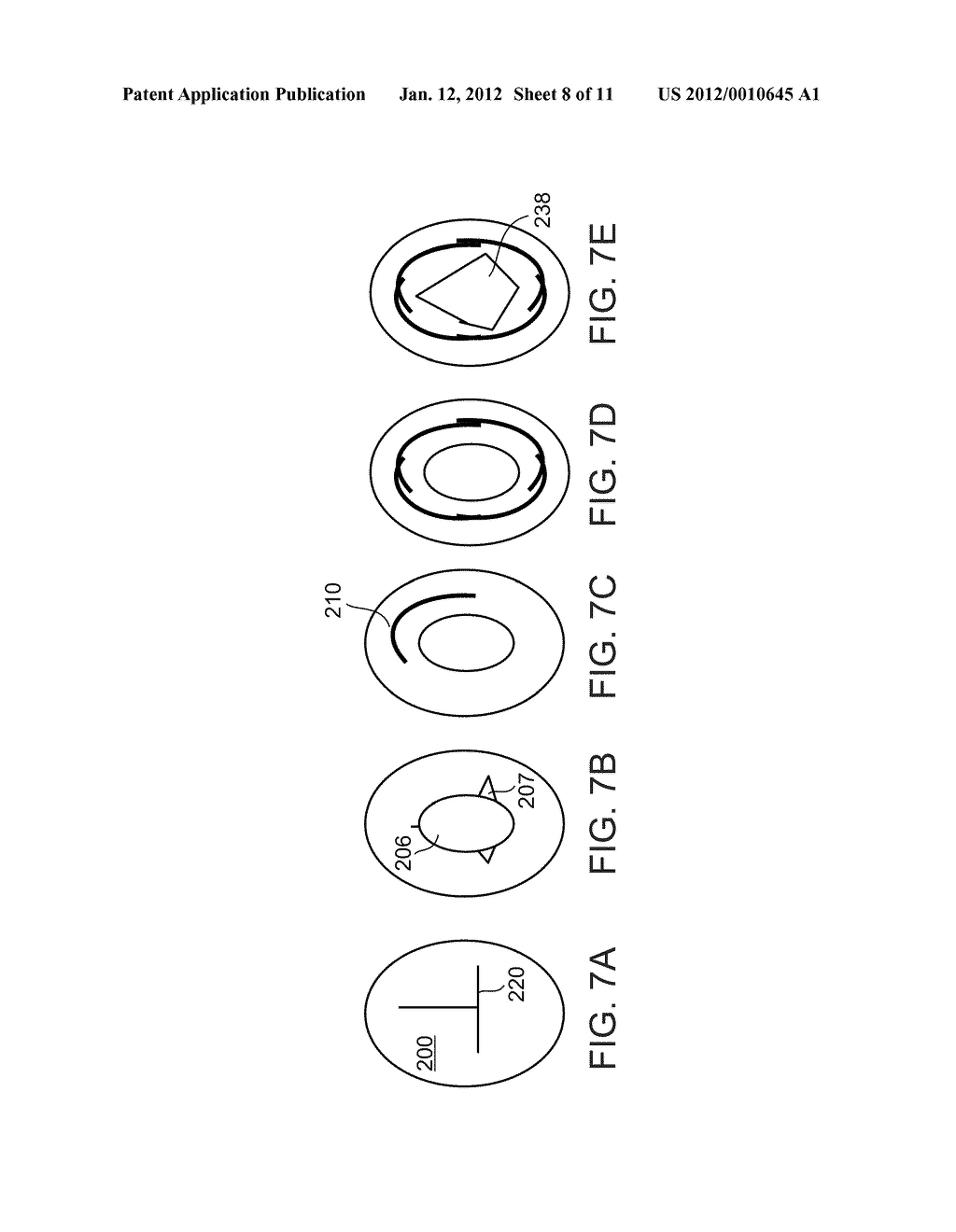 METHODS AND DEVICES FOR URETHRAL TREATMENT - diagram, schematic, and image 09