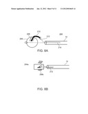 METHODS AND DEVICES FOR URETHRAL TREATMENT diagram and image