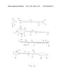 APPARATUS AND METHOD FOR TREATMENT OF SINUSITIS diagram and image