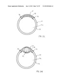 APPARATUS AND METHOD FOR TREATMENT OF SINUSITIS diagram and image