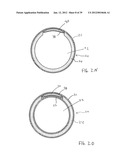 APPARATUS AND METHOD FOR TREATMENT OF SINUSITIS diagram and image