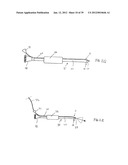 APPARATUS AND METHOD FOR TREATMENT OF SINUSITIS diagram and image