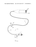 APPARATUS AND METHOD FOR TREATMENT OF SINUSITIS diagram and image