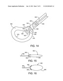 Soft Tissue Repair System diagram and image