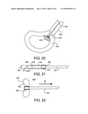 Soft Tissue Repair System diagram and image