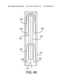 Soft Tissue Repair System diagram and image