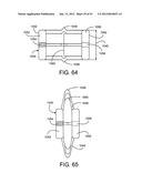 Soft Tissue Repair System diagram and image