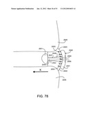 Soft Tissue Repair System diagram and image