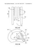 Soft Tissue Repair System diagram and image