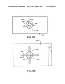 Soft Tissue Repair System diagram and image