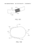 Soft Tissue Repair System diagram and image