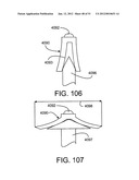 Soft Tissue Repair System diagram and image