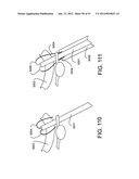 Soft Tissue Repair System diagram and image