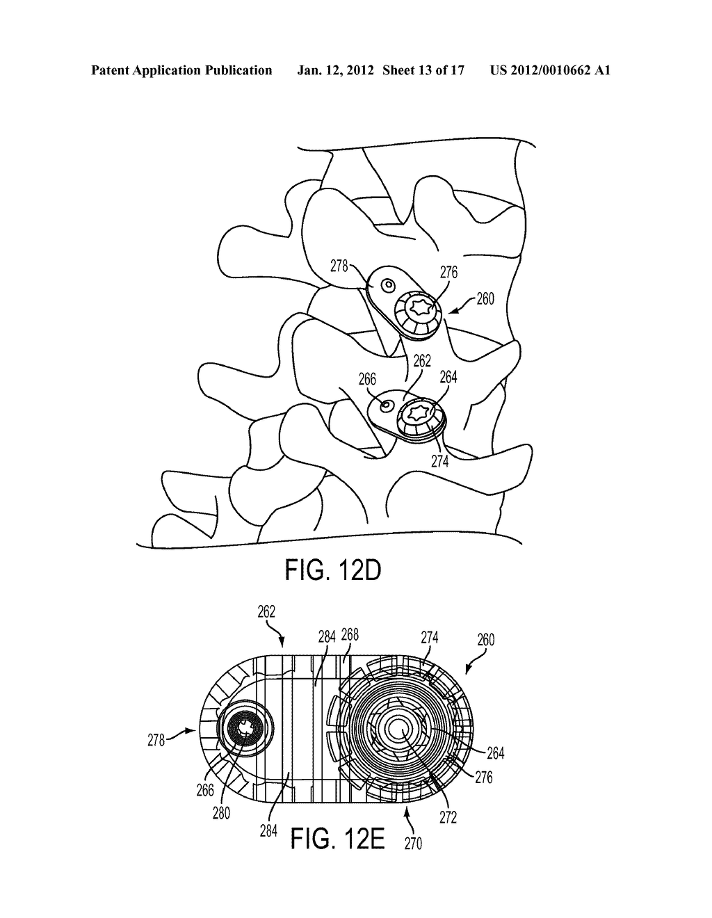 PEDICULAR FACET FUSION SCREW WITH PLATE - diagram, schematic, and image 14